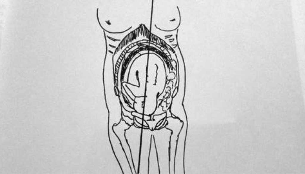 drawing-medicalview